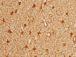 Sino Biological Human PRDX6 MAb 100ul (Sino Biological), Quantity: Each