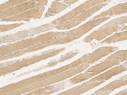 Sino Biological Anti-AMPK Antibody, Rabbit Polyclonal, Quantity: Each of