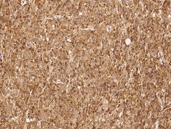 Sino Biological Anti-PSMB8/LMP7 Antibody, Rabbit Polyclonal, Quantity: