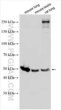 PTGIS Rabbit, anti-Human, Polyclonal, Proteintech Quantity: 150 &mu;L:Antibodies