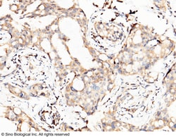 Sino Biological PTH1R / PTHR1 Antibody, Rabbit PAb, Antigen Affinity Purified