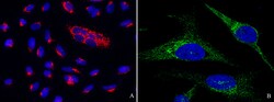 Sino Biological Recombinant Anti-PTP1B Antibody, Rabbit Monoclonal, Quantity:
