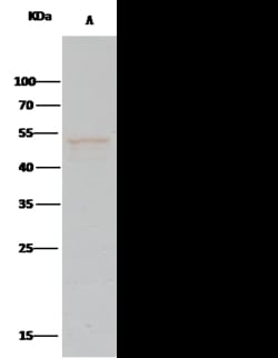 Sino Biological Recombinant Anti-PTP1B Antibody, Rabbit Monoclonal, Quantity: