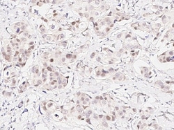 Sino Biological Anti-PYGO2/Pygopus-2 Antibody, Rabbit Polyclonal, Quantity: