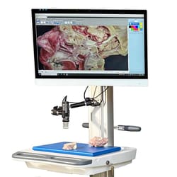 Mopec PathCam Micron Microscope Micron Camera:Autopsy Supplies, Quantity: