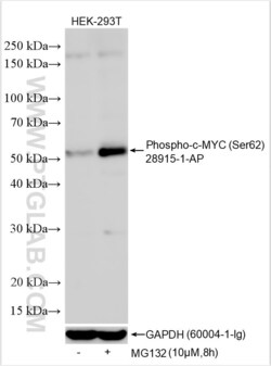 Phospho-c-MYC (Ser62) Rabbit, anti-Human, Polyclonal, Proteintech Quantity: