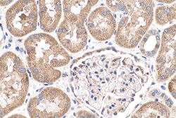 Phospholipase C epsilon 1 Rabbit, anti-Human, Polyclonal, Proteintech Quantity: