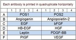 Raybiotech Inc Quantibody Human Angiogenesis Array 1 Kit.