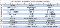 Raybiotech Inc Quantibody Human Bone Metabolism Array 1 Kit., Quantity: