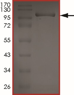 Sino Biological&nbsp;Recombinant Human RIOK2 Protein (Full Length, GST Tag)