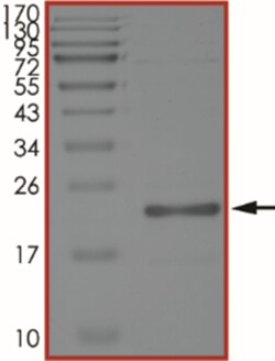 Sino Biological&nbsp;Recombinant Human KRAS Protein (G12C)
