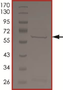 Sino Biological&nbsp;Recombinant Human RIPK2/RIP2 Protein (K47A, GST Tag)