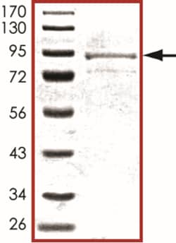 Sino Biological&nbsp;Recombinant Human RPS6KL1 Protein (Full Length, GST Tag)