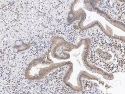 Sino Biological RAB17 Antibody, Rabbit PAb, Antigen Affinity Purified 100µL,