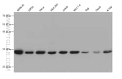 RAD1 Mouse, anti-Human, Clone: 1A11E2, Proteintech Quantity: 20 &mu;L:Antibodies