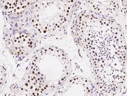 Sino Biological Anti-RAD18 Antibody, Rabbit Polyclonal, Quantity: Each