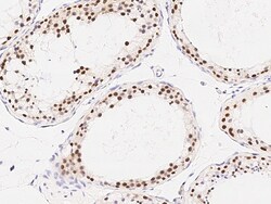 Sino Biological Anti-RAD54B Antibody, Rabbit Polyclonal, Quantity: Each