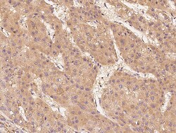 Sino Biological RAF1 Antibody, Rabbit PAb, Antigen Affinity Purified 100uL,