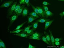 RANGAP1 Mouse, anti-Human, CoraLite Plus 488, Clone: 1F3A4, Proteintech:Antibodies:Primary