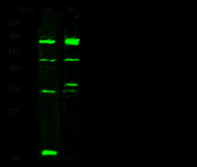 Sino Biological IL-1R1 / CD121a Antibody, Rabbit PAb, Antigen Affinity ...
