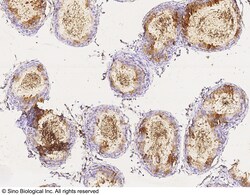Sino Biological LCN2 / NGAL Antibody, Rabbit PAb, Antigen Affinity Purified