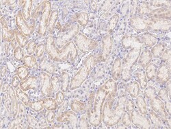 Sino Biological Anti-Leptin Receptor Antibody, Rabbit Polyclonal, Quantity: