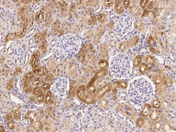 Sino Biological Anti-Syndecan-2/CD362 Antibody, Rabbit Polyclonal, Quantity: