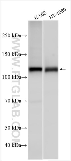 RB1 Rabbit, anti-Human, Polyclonal, Proteintech:Antibodies:Primary Antibodies