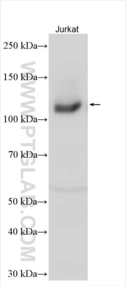 RB1 Rabbit, anti-Human, Polyclonal, Proteintech Quantity: 20 &mu;L:Antibodies