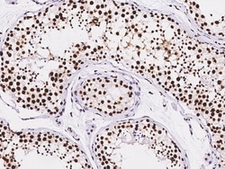 Sino Biological Anti-RbAp48 Antibody, Rabbit Polyclonal, Quantity: Each