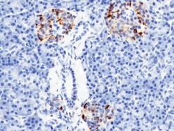 Sino Biological Anti-RBP4 Antibody, Rabbit Polyclonal, Quantity: Each of