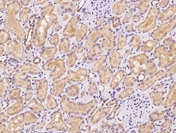 Sino Biological RDH14 Antibody, Rabbit PAb, Antigen Affinity Purified 100µL,