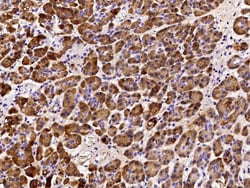 Sino Biological Human REG1B MAb 100ul (Sino Biological), Quantity: Each