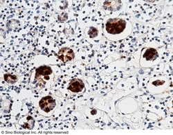 Sino Biological REG3A Antibody, Rabbit MAb 100uL, Quantity: Each of 1