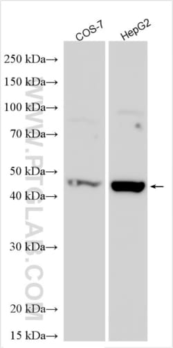 REN Rabbit, anti-Human, Polyclonal, Proteintech Quantity: 20 &mu;L:Antibodies