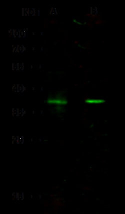 Sino Biological DKK-1 Antibody, Rabbit PAb, Antigen Affinity Purified 100µL,