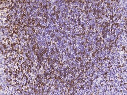 Sino Biological Anti-CD3 epsilon/CD3e Antibody, Mouse Monoclonal, Quantity: