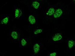 Sino Biological Anti-RING1 Antibody, Rabbit Polyclonal, Quantity: Each