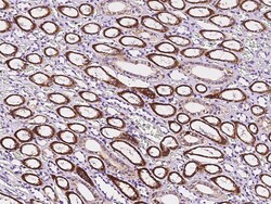 Sino Biological Anti-RNF11 Antibody, Rabbit Polyclonal, Quantity: Each