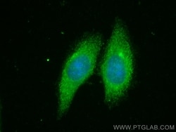 RNF217 Rabbit, anti-Human, Polyclonal, Proteintech:Antibodies:Primary Antibodies