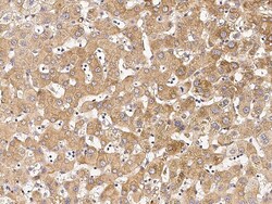 Sino Biological RNF217 Antibody, Rabbit PAb, Antigen Affinity Purified