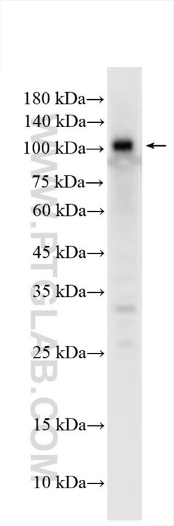 RNF31 / HOIP Rabbit, anti-Human, Polyclonal, Proteintech:Antibodies:Primary