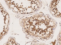 Sino Biological Anti-ROPN1L Antibody, Rabbit Polyclonal, Quantity: Each