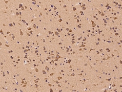 Sino Biological RORB Antibody, Rabbit PAb, Antigen Affinity Purified 100µL,