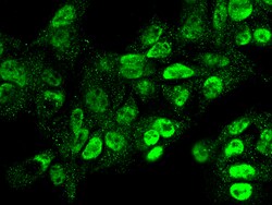 Sino Biological Anti-RSK2 Antibody, Rabbit Polyclonal, Quantity: Each of