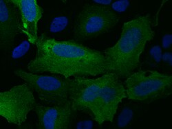Sino Biological RRM2 Antibody, Rabbit PAb, Antigen Affinity Purified 100µL,