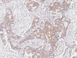 Sino Biological Anti-RUVBL1 Antibody, Rabbit Polyclonal, Quantity: Each