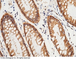 Sino Biological S100A16 Antibody, Rabbit PAb, Antigen Affinity Purified