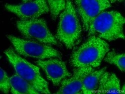 S100A6 Mouse, anti-Human, CoraLite Plus 488, Clone: 3D11C8, Proteintech:Antibodies:Primary