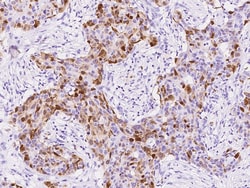 Sino Biological S100A8 Antibody, Rabbit MAb 100µL, Quantity: Each of 1